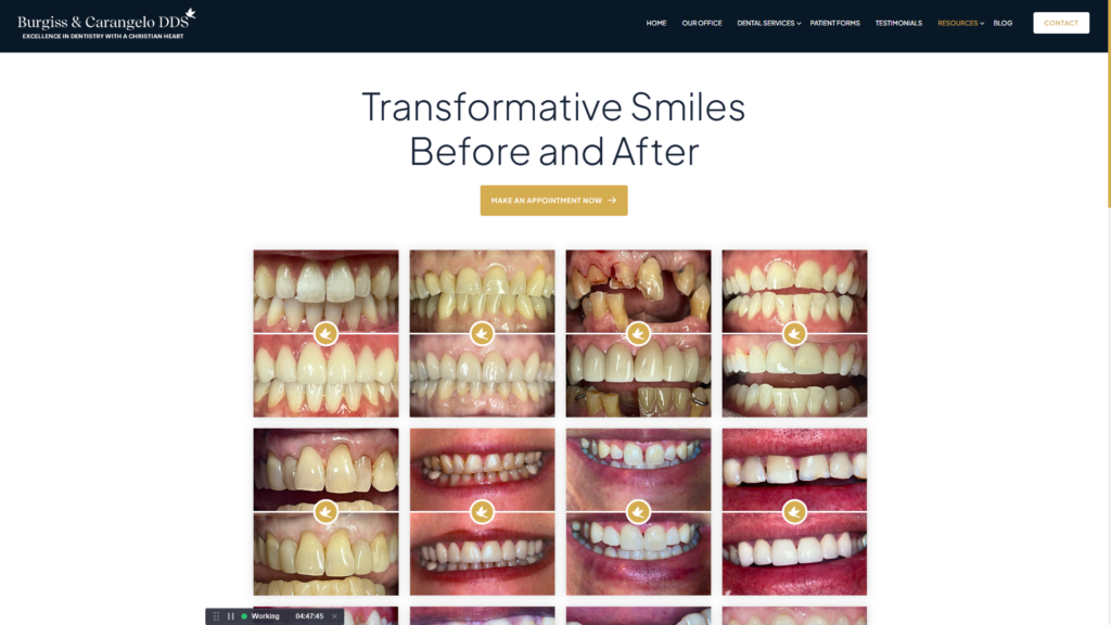 Burgiss & Carangelo DDS website before-and-after smile gallery
